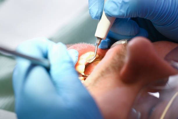 Best Urgent Tooth Repair  in Amite City, LA