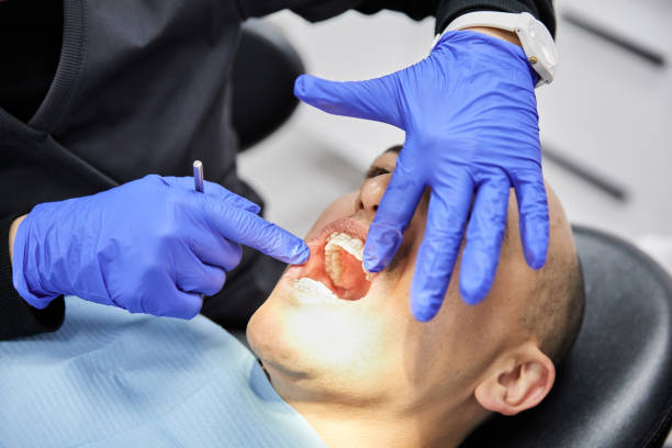 Best Chipped Tooth Repair Near Me  in Amite City, LA